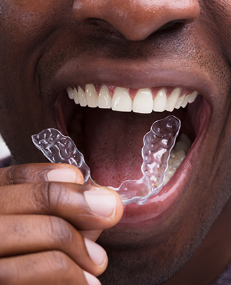 invisalign