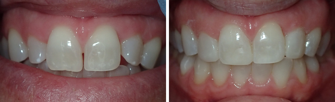 before and after image