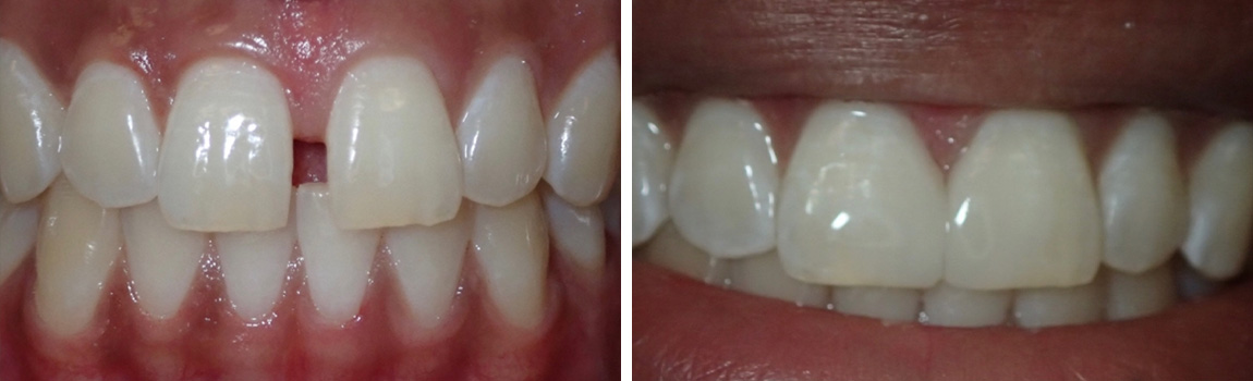 before and after image