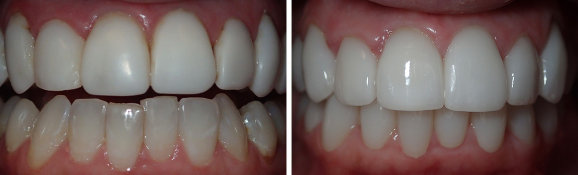 before and after image