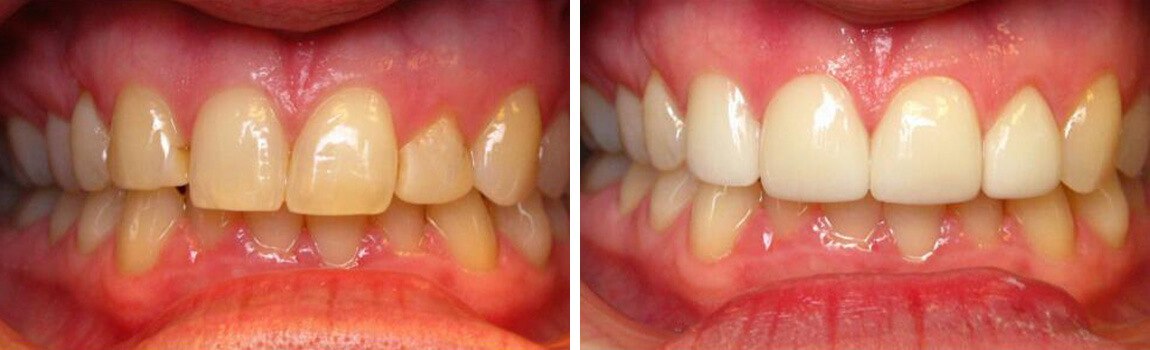 before and after image