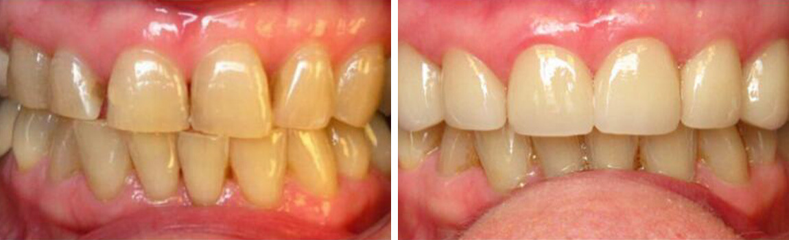 before and after image