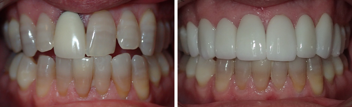 before and after image