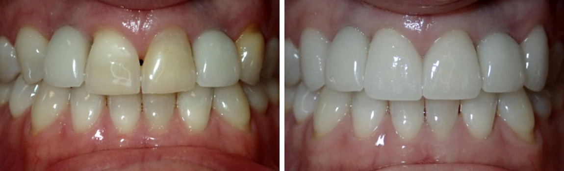 before and after image