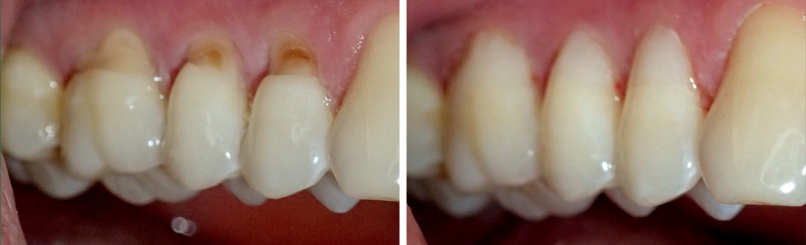 before and after image