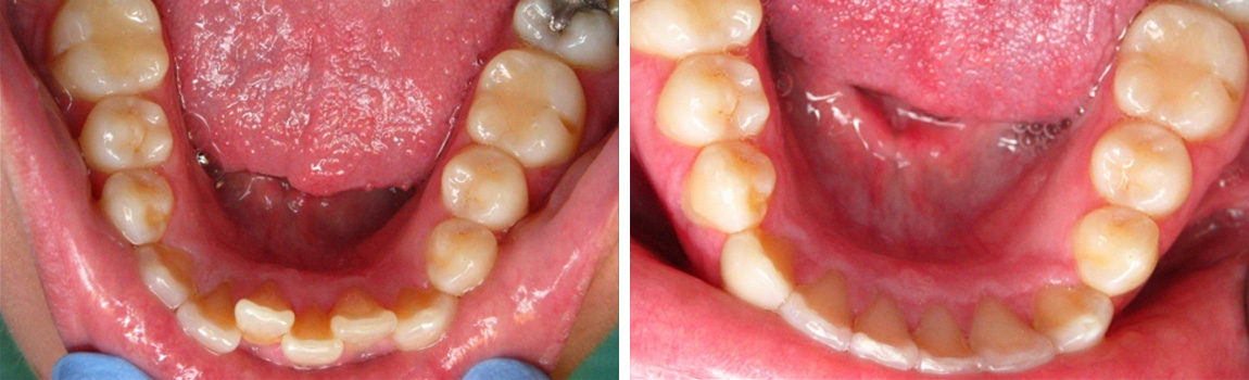 before and after image