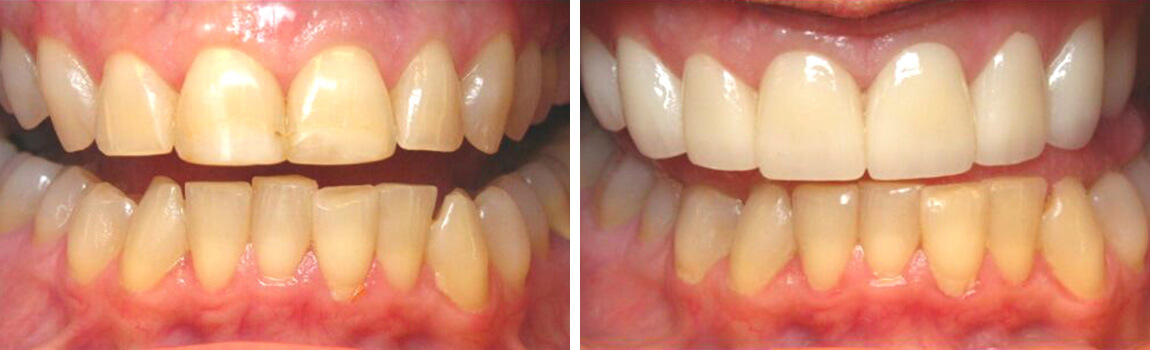 before and after image