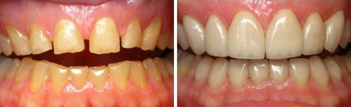before and after image