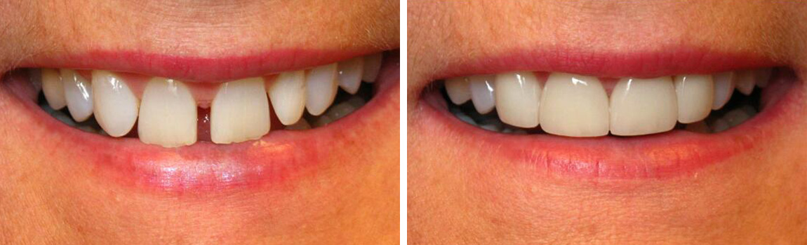 before and after image