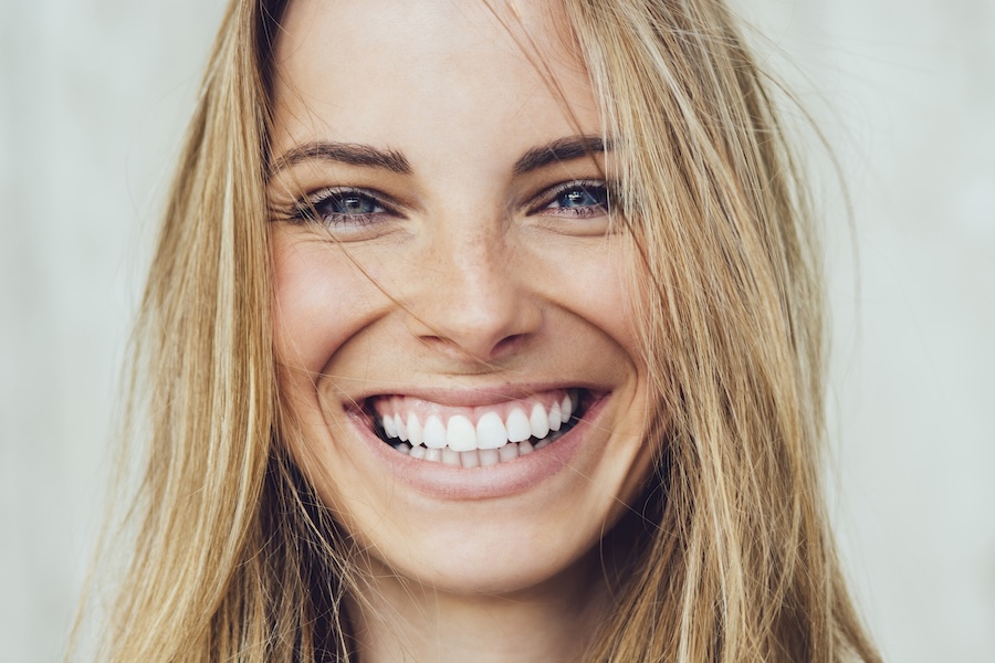 smiling women after professional teeth whitening, prevent stains 48 hours rules